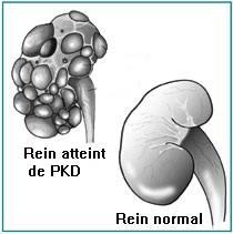 Pkd